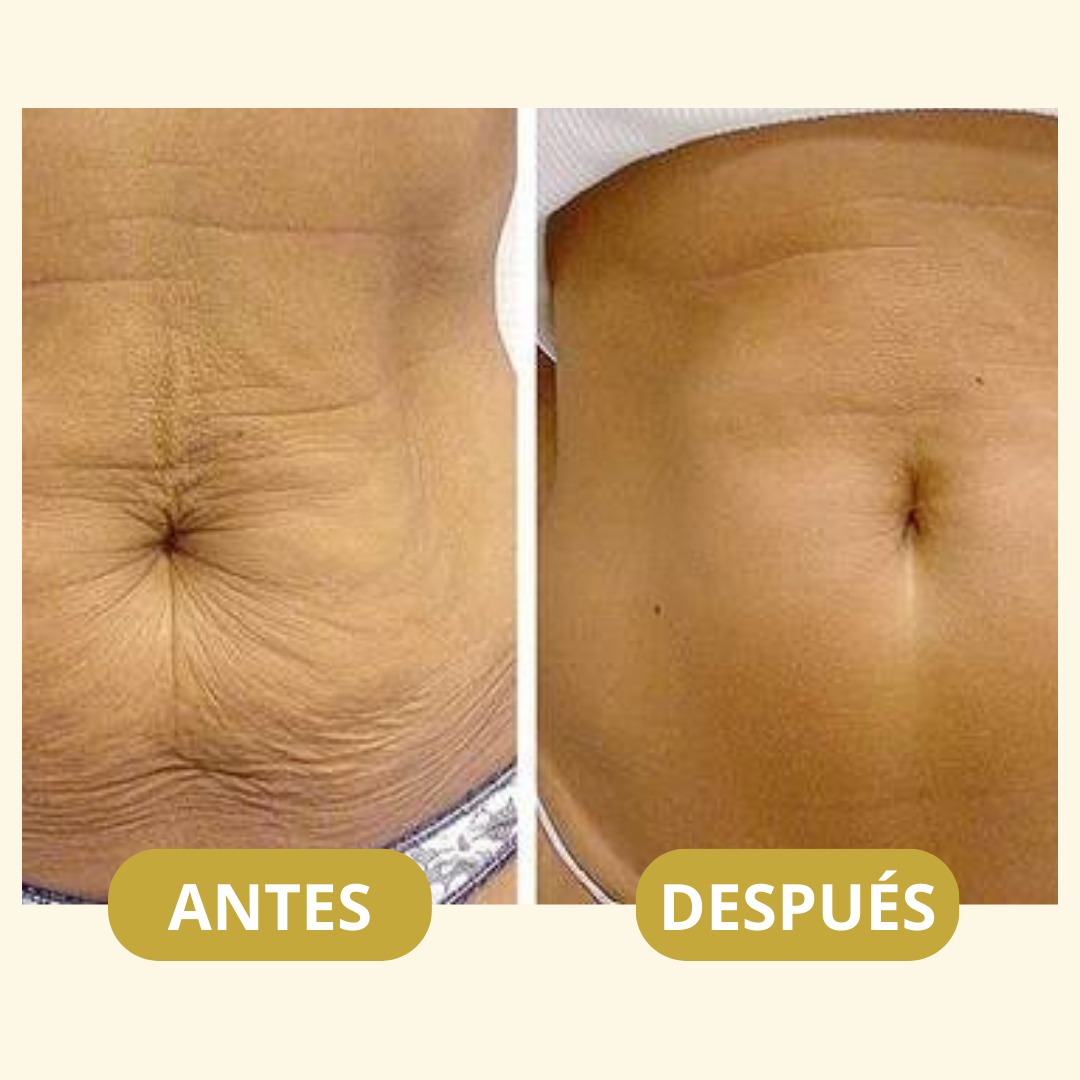 MagicFirm™ Aceite Premium Anti-Edad