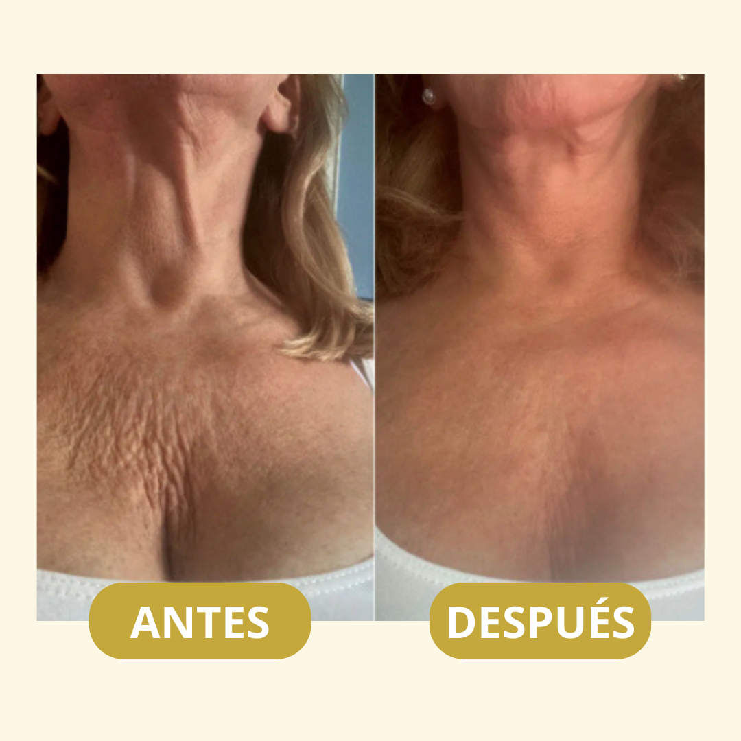 MagicFirm™ Aceite Premium Anti-Edad