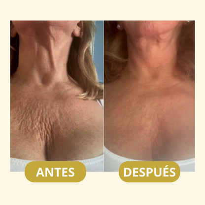 MagicFirm™ Aceite Premium Anti-Edad