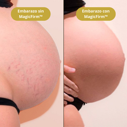 MagicFirm™ Aceite Premium Anti-Edad